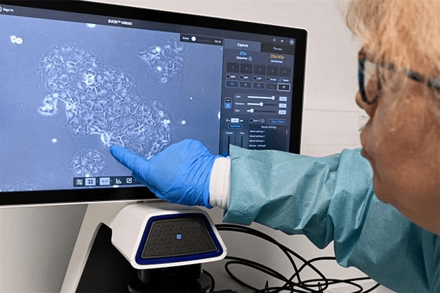 Médecine : Des avancées prometteuses contre le cancer du pancréas